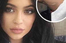 kylie jenner scar loves huge kendall