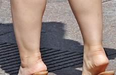 soles calves toes