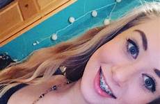 braces teens girls cute beautiful beauty smile choose board saved tips uploaded user