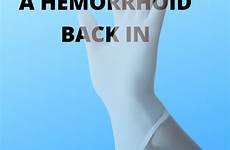 hemorrhoid hemorrhoids push prolapsed popped