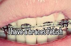 braces fetish