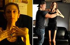 anorexic rachael woman anorexia farrokh after video treatment thanks donors raising nearly 200k disorders eating severe who actress body 6abc