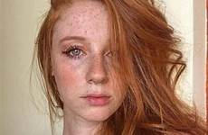 freckles redheads