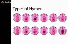 hymen human