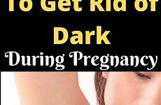 pregnancy areolas darkening
