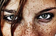 freckles dimples intense freckle fair crusca freckledgirls