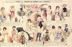 anciennes poussiere29 1884 corsets breasts