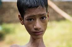head indian boy teenager india neck mahendra his surgery changing after side angle born degree life school weak upside muscles