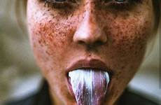 freckles kauwgom