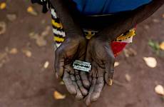 genital female mutilation fgm