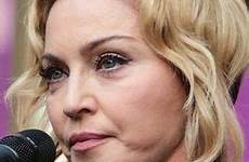 madonna face puffy swollen shocks concert fans sound change latest sparked networking discussion huge social sites