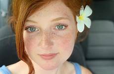 annah freckles freckle redheads freckledgirls thoughts happygirl 9gag