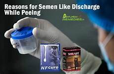 semen discharge peeing while reasons