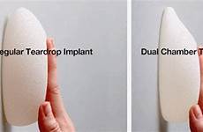 implants breast drop teardrop implant tear gif augmentation natural breasts shaped shape results