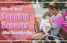 breastfeeding after breasts sagging