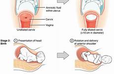 childbirth stages dilation afterbirth
