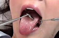 dental dentist exam bdsm ago years blowjob gangbang rhoades lana