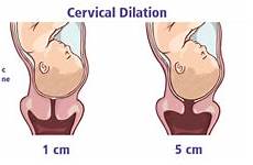 vaginal dilation cervical exams evidence