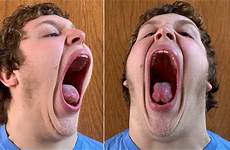 mouth gape largest world has worlds record pennsylvania teen share