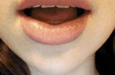 lips biting braces ám azta