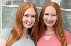 twins ginger comments