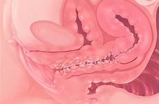 ray internal mag section cross anatomy uterus cervix drawn xxx female original danbooru information posts respond edit