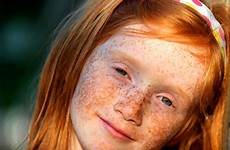 rousse peau bronzer bronzage rousses naturelle taches roux soleil cuties rousseur visiter quand égales sommes freckles ou