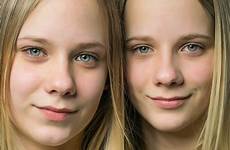 twins identical genetically