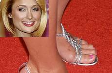 feet celebrity paris hilton ugly toes pretty foot heels face long ugliest women female size celebrities health high bunion hammer