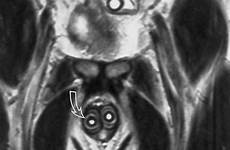 penis penile imaging radiographics coronal