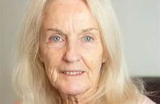 facelift grandmother grandma coffin 10k risks swns reckons
