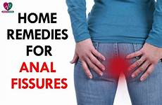 anus tear anal medical questions fissures remedies