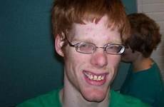 ugly ginger gingers geek think scary universityprimetime