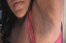 armpit stubble