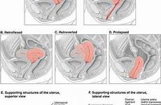 ultrasound transabdominal pelvic uterus retroverted anatomy cervix sonography radiology