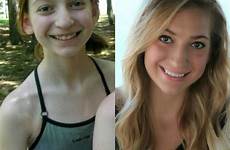 puberty transformation