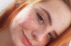 sardas freckles ruivas meninas ruivo ruivos cabelos ruiva redheads redhead cabelo rosto bonita freckle