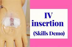 iv insertion skills