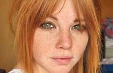 redheads freckles blazing sommersprossen