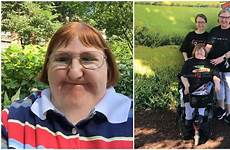 melissa ugly blake so selfies too hit bbc trolls disability blogger said back source