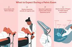 pelvic exam examination expect gynecologist verywell