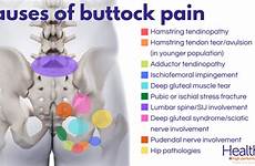 buttock diagnosis