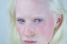 albinism albino albinismo albinos albinas gente humanos persone albina alb fotografías menschen caucasian muestran bellezza mostrano queste beleza haare