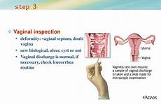 examination physical gynecological check history vaginal vagina virgin speculum inspection ppt normal discharge ulcer necessary