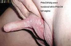 clit hermaphrodite huge clitoris genital anomalies abnormal giant organs hot