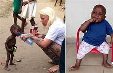 starving boy after viral thriving rescue toddler next foxnews