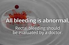 toilet bleeding blood rectal rectum stool colon hemorrhoids fissure crohn disease colitis occasional