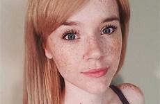 freckles redhead