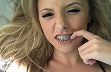 braces eslamoda exclusivas mouth piercing brace frenillo dentales aparelho leerlo boca frenillos dedo niñas