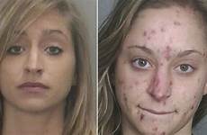 meth before after mugshots show horror drug user addiction users mirror